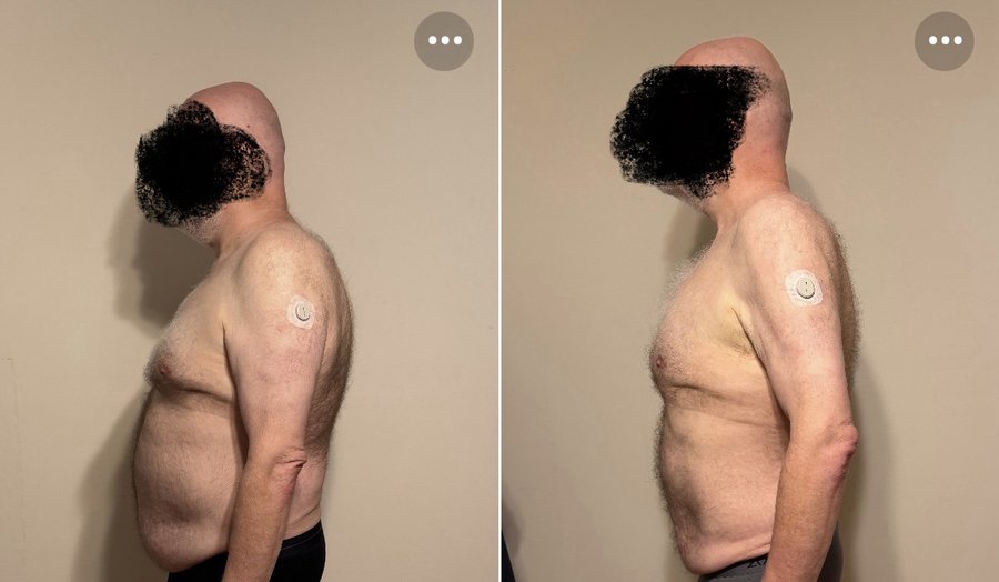 Client side profile transformation, lost 30 pounds in 6 months